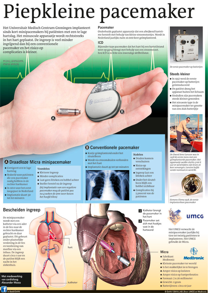 PIEPKLEINE PACEMAKER